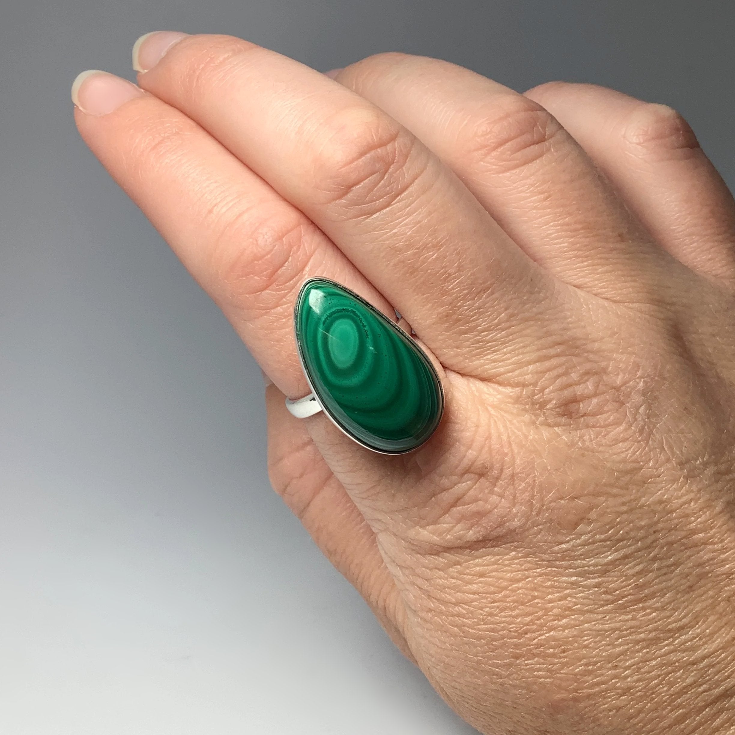 Malachite Ring